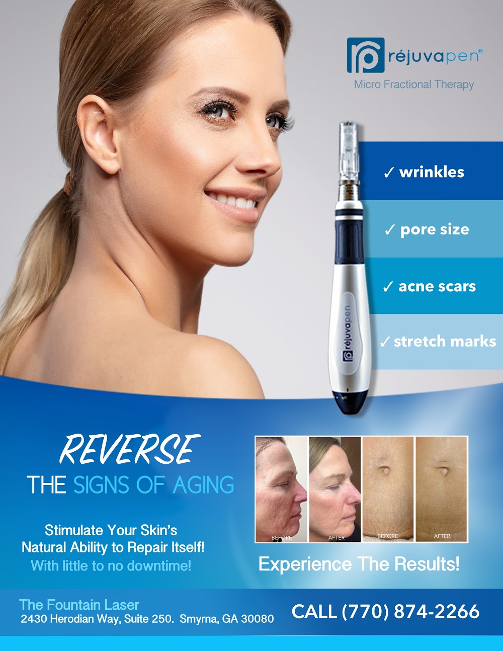 Fountain Laser – Atlanta Hair Removal