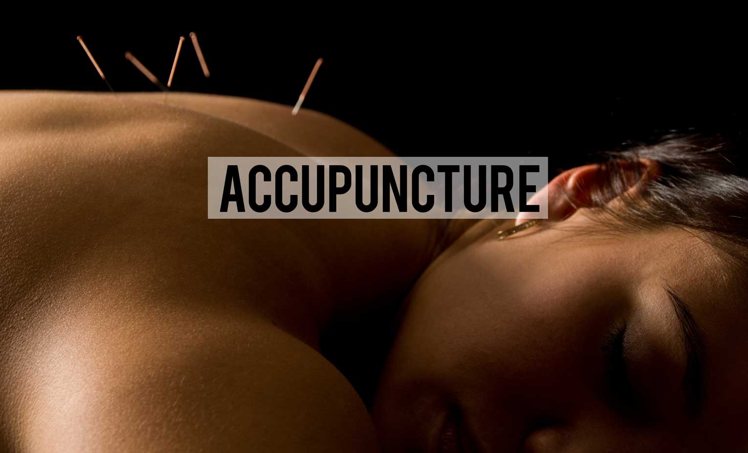 Accupuncture Atlanta
