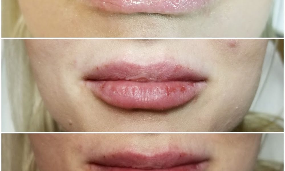 Natural Injections by Laura Medspa