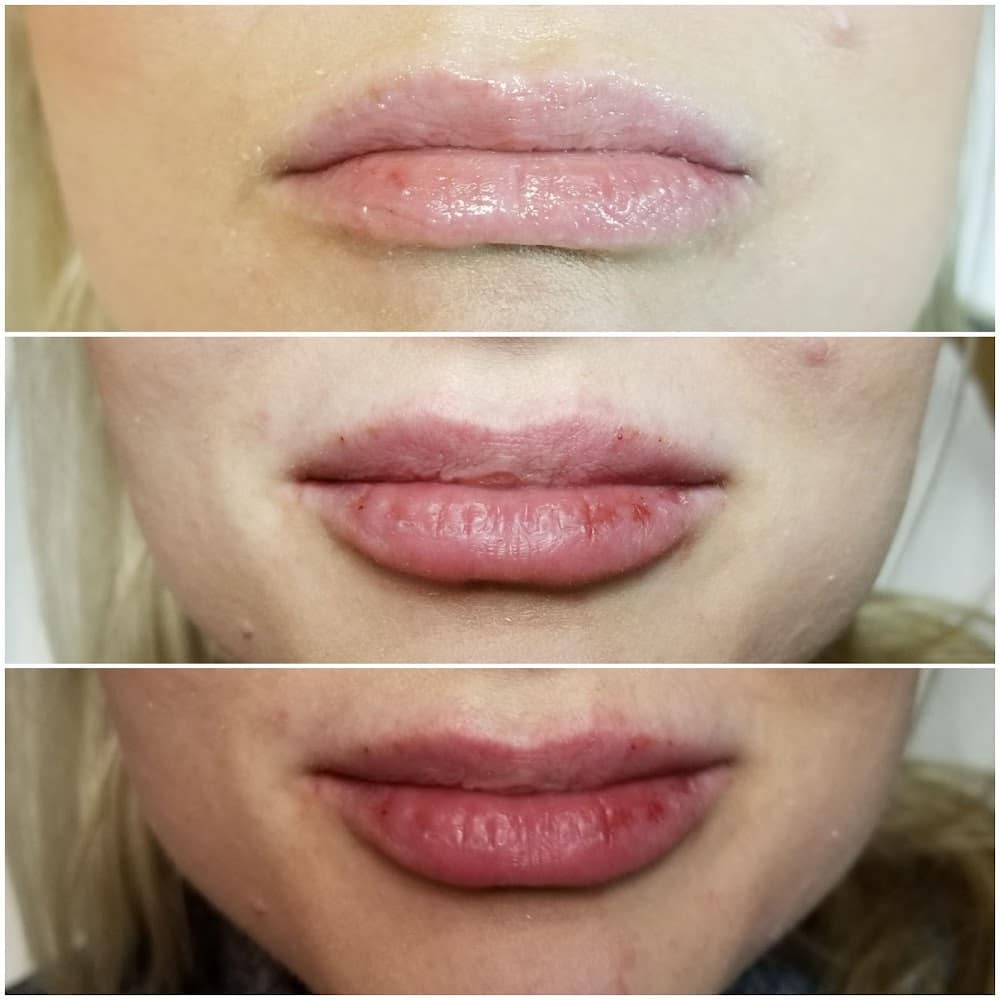 Natural Injections by Laura Medspa