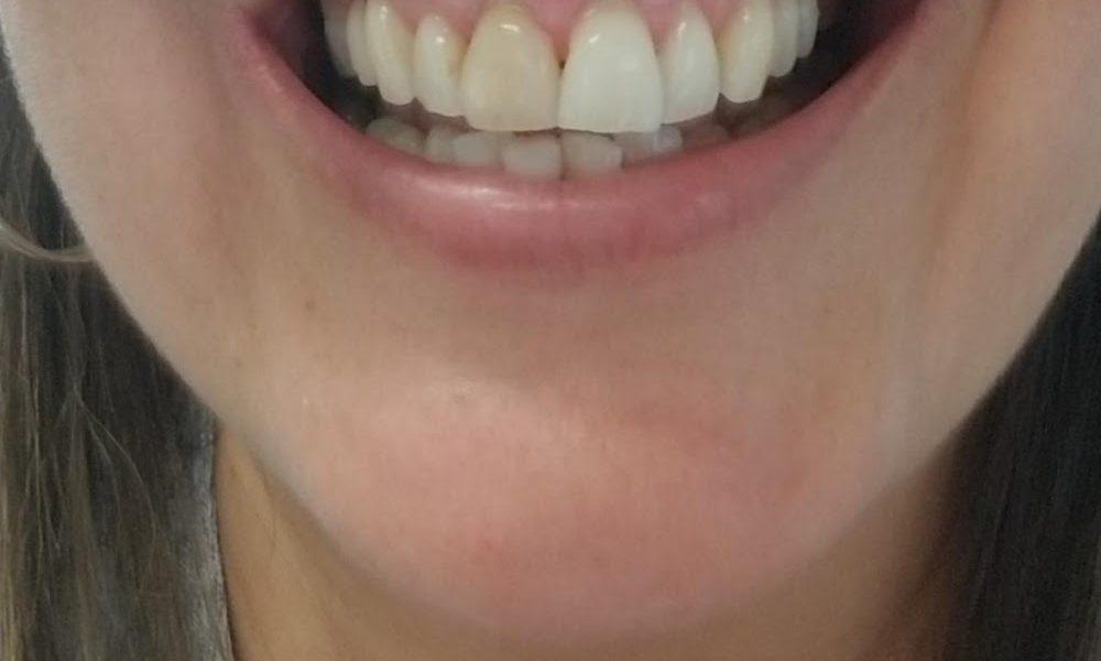 Old Alabama Dental Care