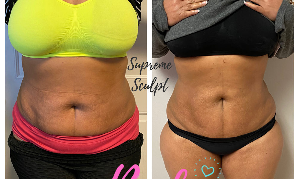 Supreme Body Studio