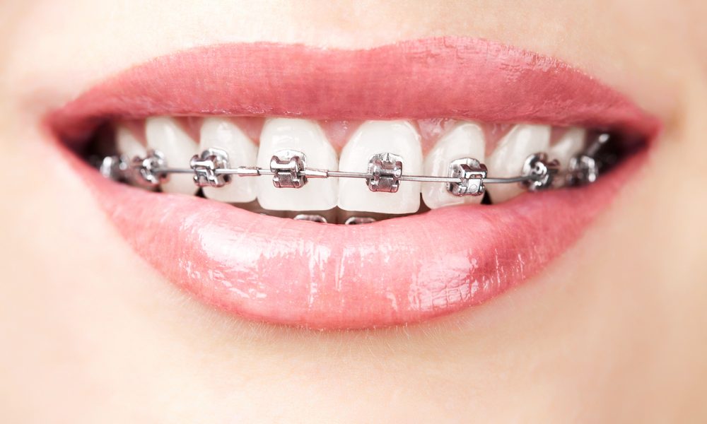 Tipton Orthodontics