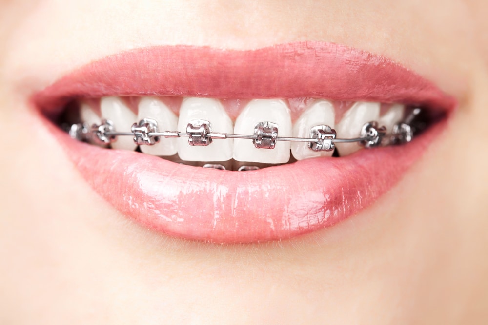 Tipton Orthodontics